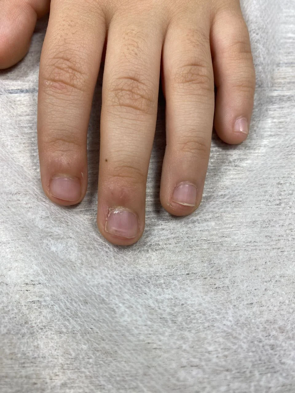 Кейс 2 фото 3